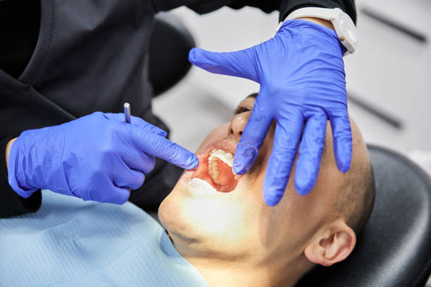Best Cracked Tooth Emergency Dentist  in Mather, CA